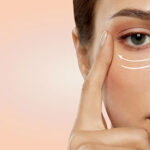 Blepharoplasty Recovery Timeline: What to Expect After Eyelid Surgery