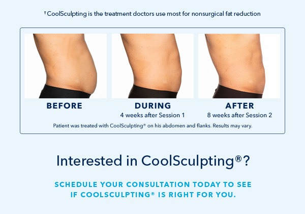 CoolSculpting®