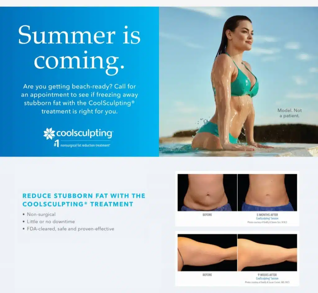 CoolSculpting for a perfect beach body
